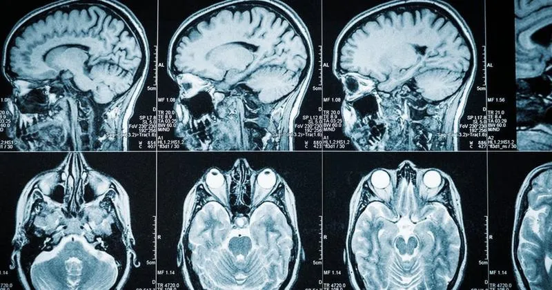 Wsparcie psychologiczne